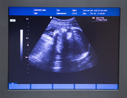Modern methods of examination of pregnant women () Modern methods of examination of pregnant women
