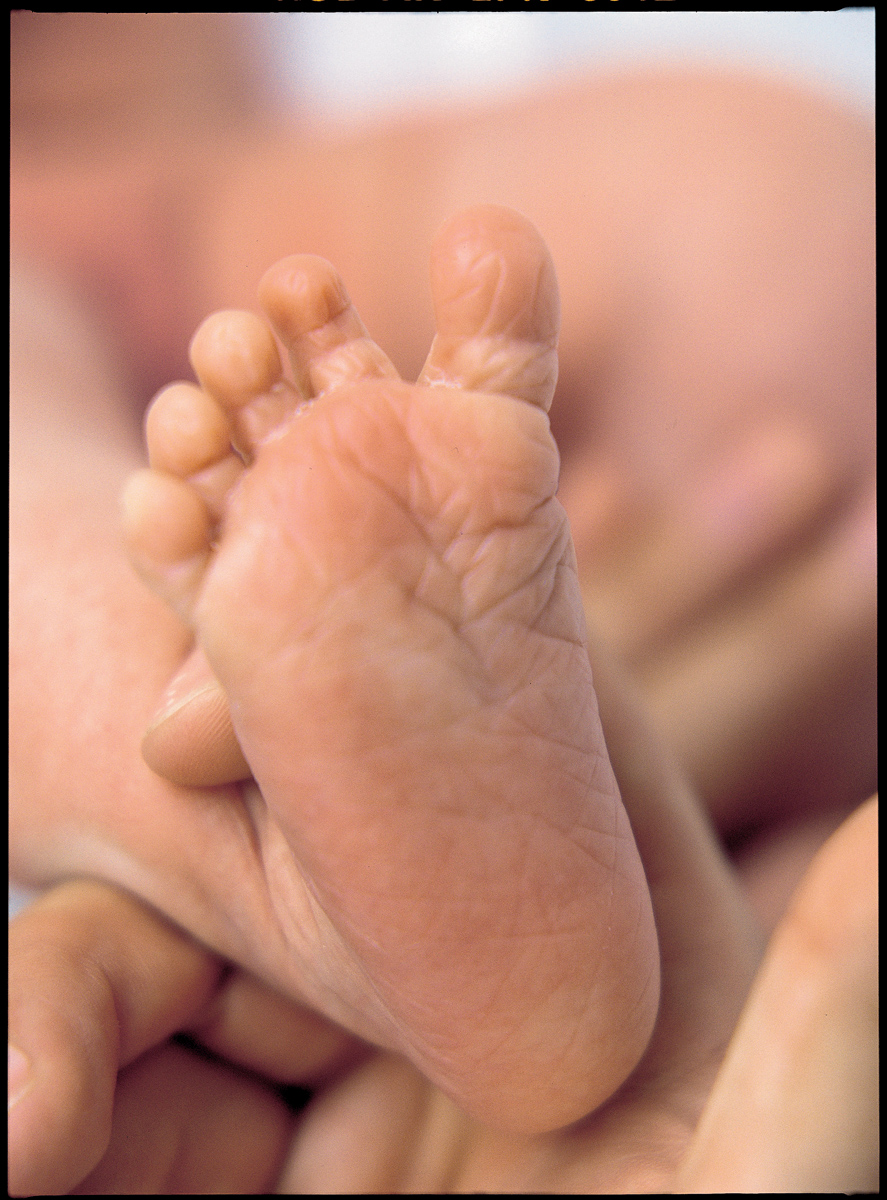 Cribado neonatal () Cribado neonatal