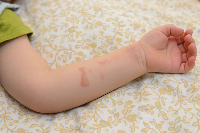 We act without delay: 6 emergency situations with children () We act without delay: 6 emergency situations with children